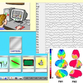 Mapeamento Cerebral com EEG